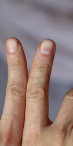 Hands with slightly bent fingers indicating trigger finger